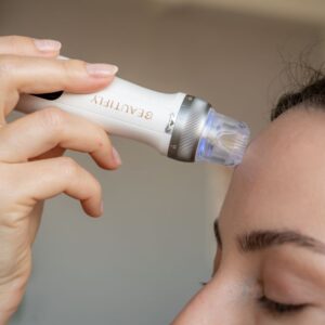 Beautifly CollagenBoost Dermapen - Image 2