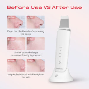 MAXGROOM M-169 ultrasonic cavitation peeling device with LED light therapy - white - Image 9